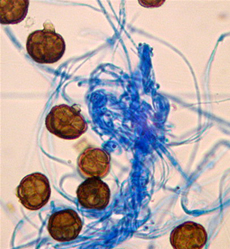 Deuteromycetes as Pathogens
